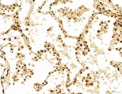 Invitrogen Cyclin A Polyclonal Antibody 100 &mu;L; Unconjugated:Antibodies,