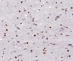 Invitrogen DNA Polymerase beta Polyclonal Antibody 100 &mu;L; Unconjugated:Antibodies,