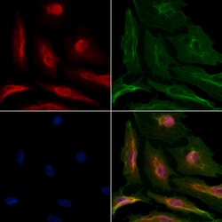 Invitrogen DNA Polymerase beta Polyclonal Antibody 100 &mu;L; Unconjugated:Antibodies,