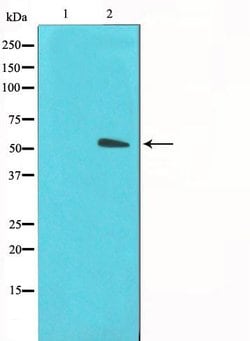 Invitrogen GLUT3 Polyclonal Antibody 100 &mu;L | Buy Online | Invitrogen&trade; | Fisher Scientific