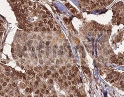 Invitrogen HDAC10 Polyclonal Antibody 100 &mu;L; Unconjugated:Antibodies,