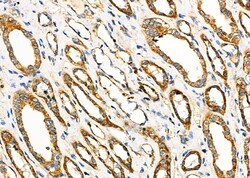 Invitrogen HSPE1 Polyclonal Antibody 100 &mu;L; Unconjugated:Antibodies,