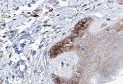 Invitrogen Cytokeratin 16 Polyclonal Antibody 100 &mu;L; Unconjugated:Antibodies,