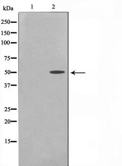Invitrogen Cytokeratin 16 Polyclonal Antibody 100 &mu;L; Unconjugated:Antibodies,