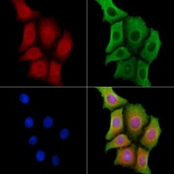 Invitrogen Mammaglobin B Polyclonal Antibody 100 &mu;L; Unconjugated:Antibodies,