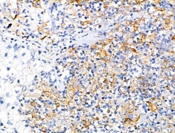 Invitrogen Mammaglobin B Polyclonal Antibody 100 &mu;L; Unconjugated:Antibodies,