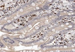 Invitrogen Mammaglobin B Polyclonal Antibody 100 &mu;L; Unconjugated:Antibodies,