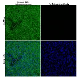 Invitrogen Melan-A Polyclonal Antibody 100 &mu;L; Unconjugated:Antibodies,