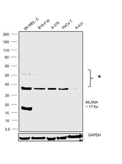 Invitrogen Melan-A Polyclonal Antibody 100 &mu;L; Unconjugated:Antibodies,