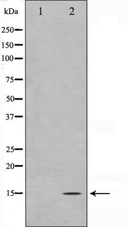 Invitrogen Melan-A Polyclonal Antibody 100 &mu;L; Unconjugated:Antibodies,