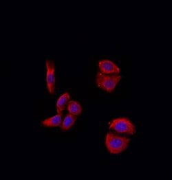 Invitrogen MMP11 Polyclonal Antibody 100 &mu;L; Unconjugated:Antibodies,