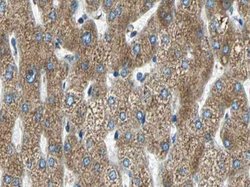 Invitrogen MMP11 Polyclonal Antibody 100 &mu;L; Unconjugated:Antibodies,