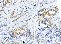 Invitrogen MMP11 Polyclonal Antibody 100 &mu;L; Unconjugated:Antibodies,