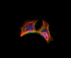 MMP23 Polyclonal Antibody:Antibodies, Polyclonal