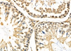 MMP23 Polyclonal Antibody:Antibodies, Polyclonal