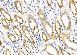 Invitrogen NME2 Polyclonal Antibody 100 &mu;L; Unconjugated:Antibodies,