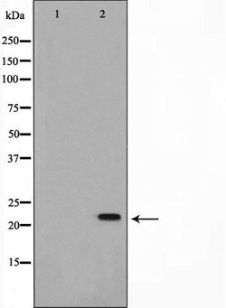 Invitrogen NME2 Polyclonal Antibody 100 &mu;L; Unconjugated:Antibodies,