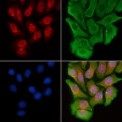 Invitrogen PCAF Polyclonal Antibody 100 &mu;L | Buy Online | Invitrogen&trade; | Fisher Scientific