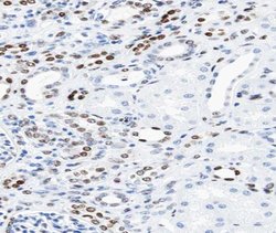Invitrogen PCAF Polyclonal Antibody 100 &mu;L | Buy Online | Invitrogen&trade; | Fisher Scientific