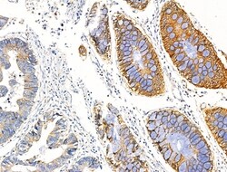 Invitrogen PCAF Polyclonal Antibody 100 &mu;L | Buy Online | Invitrogen&trade; | Fisher Scientific