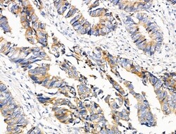 Invitrogen PCAF Polyclonal Antibody 100 &mu;L | Buy Online | Invitrogen&trade; | Fisher Scientific