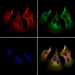 Invitrogen PTH Polyclonal Antibody 100 &mu;L | Buy Online | Invitrogen&trade; | Fisher Scientific