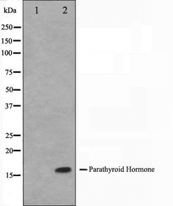 Invitrogen PTH Polyclonal Antibody 100 &mu;L | Buy Online | Invitrogen&trade; | Fisher Scientific