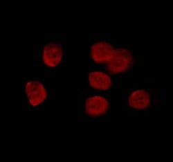 RCBTB1 Polyclonal Antibody:Antibodies, Polyclonal
