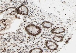RCBTB1 Polyclonal Antibody:Antibodies, Polyclonal