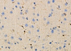 RCBTB1 Polyclonal Antibody:Antibodies, Polyclonal