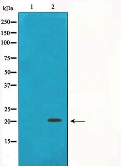 Invitrogen gamma Synuclein Polyclonal Antibody 100 &mu;L; Unconjugated:Antibodies,