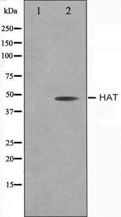 Invitrogen HAT1 Polyclonal Antibody 100 &mu;L | Buy Online | Invitrogen&trade; | Fisher Scientific