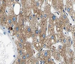 Invitrogen NYREN18 Polyclonal Antibody 100 &mu;L; Unconjugated:Antibodies,