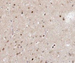 Invitrogen SENP7 Polyclonal Antibody 100 &mu;L; Unconjugated:Antibodies,