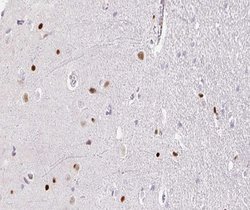 Invitrogen TOP2B Polyclonal Antibody 100 &mu;L; Unconjugated:Antibodies,
