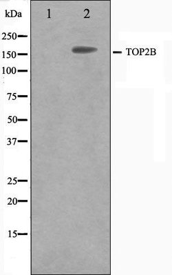 Invitrogen TOP2B Polyclonal Antibody 100 &mu;L; Unconjugated:Antibodies,