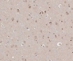 Invitrogen TRADD Polyclonal Antibody 100 &mu;L | Buy Online | Invitrogen&trade; | Fisher Scientific