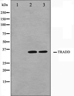 Invitrogen TRADD Polyclonal Antibody 100 &mu;L | Buy Online | Invitrogen&trade; | Fisher Scientific