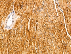 Invitrogen ANO9 Polyclonal Antibody 100 &mu;L; Unconjugated:Antibodies,