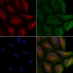 TP53I11 Polyclonal Antibody, Invitrogen&trade;