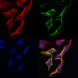 TP53I11 Polyclonal Antibody, Invitrogen&trade;