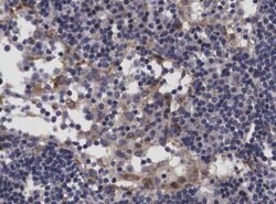 TP53I11 Polyclonal Antibody, Invitrogen&trade;