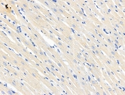 TP53I11 Polyclonal Antibody, Invitrogen&trade;