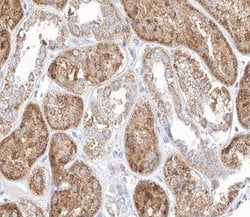 Invitrogen MID1 Polyclonal Antibody 100 &mu;L; Unconjugated:Antibodies,