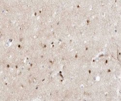 Invitrogen ZIC1/ZIC2/ZIC3 Polyclonal Antibody 100 &mu;L; Unconjugated:Antibodies,