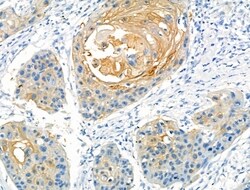 Invitrogen ZIC1/ZIC2/ZIC3 Polyclonal Antibody 100 &mu;L; Unconjugated:Antibodies,