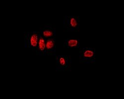 Invitrogen LMX1B Polyclonal Antibody 100 &mu;L; Unconjugated:Antibodies,