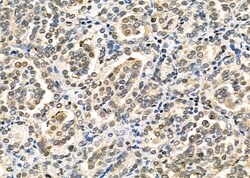 Invitrogen LMX1B Polyclonal Antibody 100 &mu;L; Unconjugated:Antibodies,