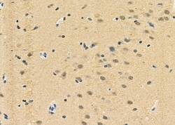 Invitrogen LMX1B Polyclonal Antibody 100 &mu;L; Unconjugated:Antibodies,