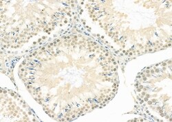 Invitrogen LMX1B Polyclonal Antibody 100 &mu;L; Unconjugated:Antibodies,